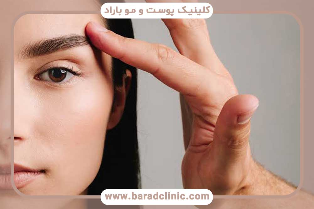 اهمیت دوز مناسب مزوتراپی ابرو