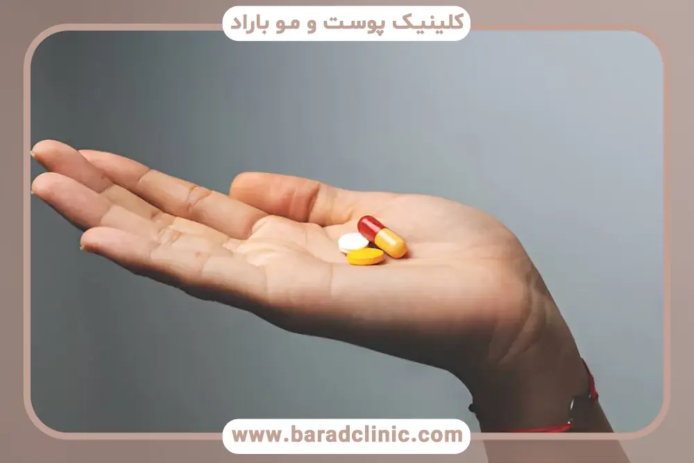 بهترین زمان مصرف قرص یونی زینک بعد از کاشت مو 