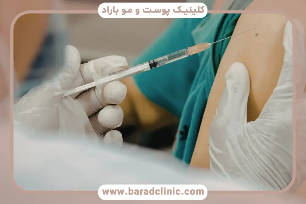 مراحل انواع پی آر پی (PRP) 