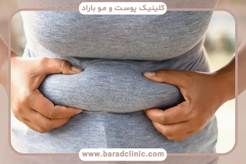 تداخلات دارویی قرص لاغری جی سی