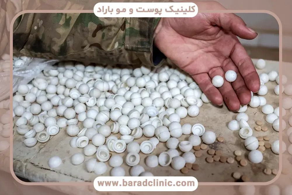 نحوه مصرف بهترین مسکن بعد از کاشت مو