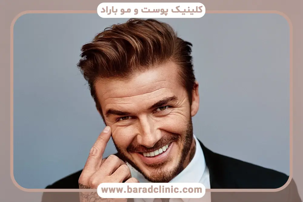 بهترین کلینیک کاشت مو fci در ایران 