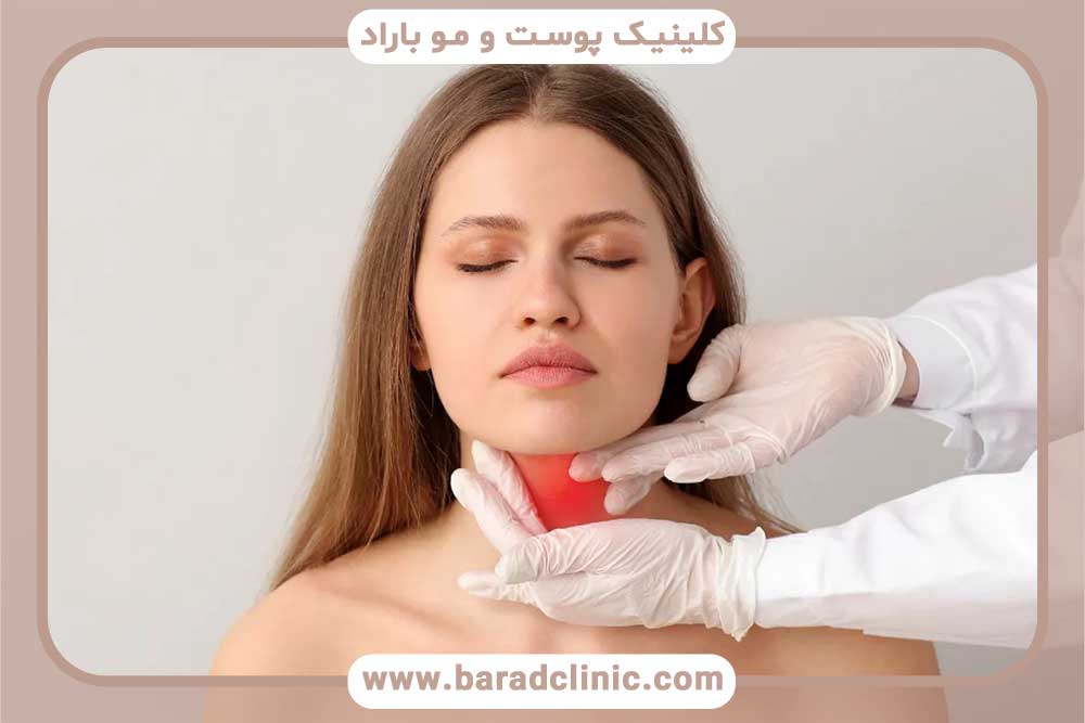 کم کاری تیروئید و کاشت ابرو