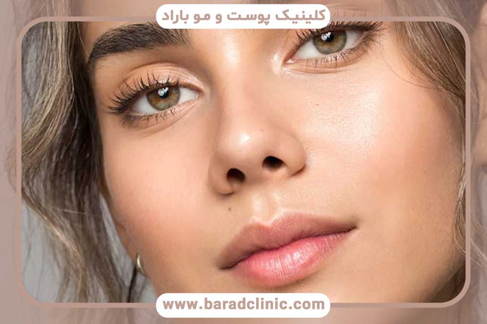 هزینه کاشت ابرو