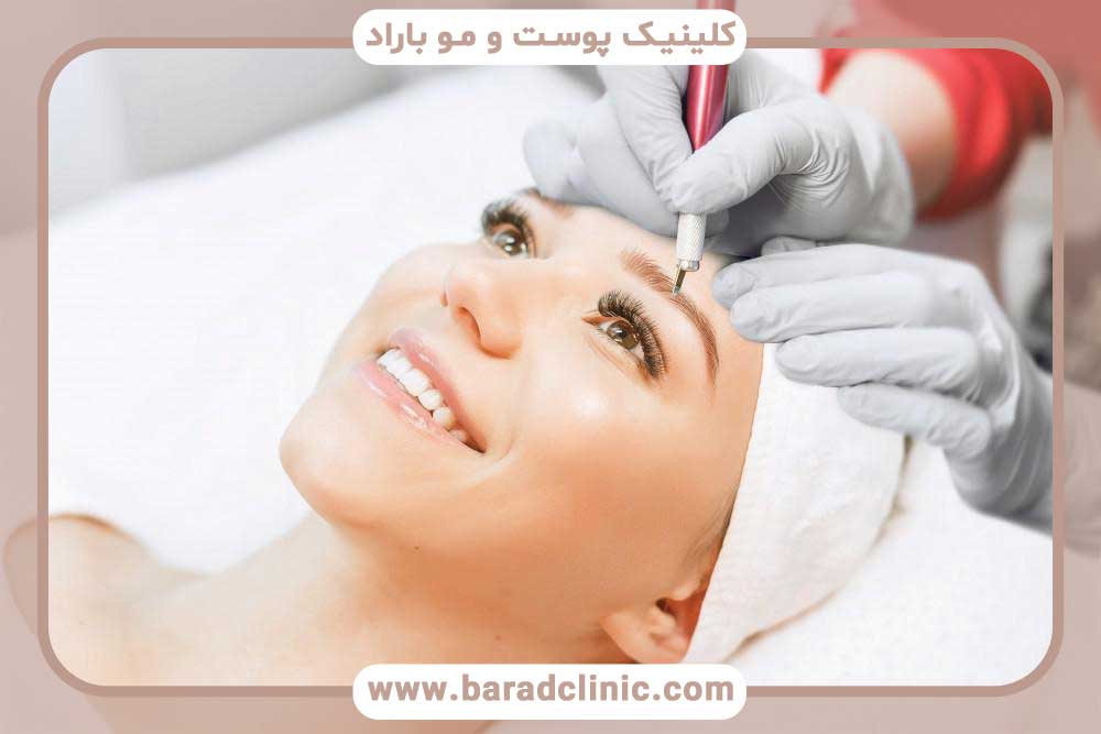عوارض میکروبلیدینگ