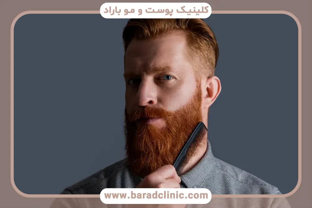 ریزش ریش طبیعی است؟