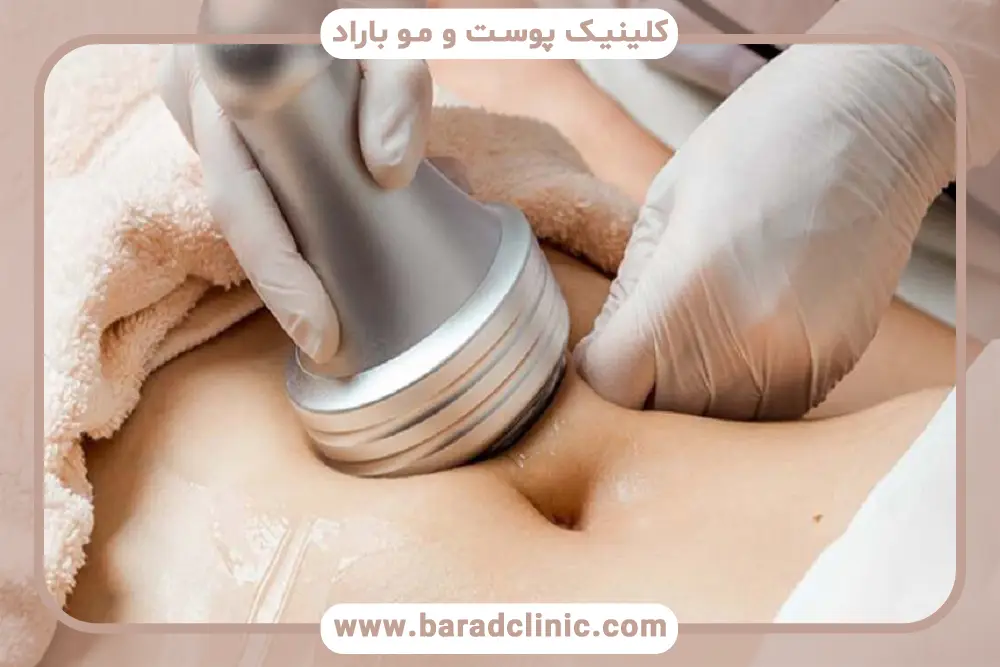 هزینه لاغری با دستگاه اگزیمیا