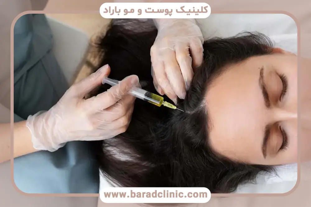 مقایسه مزوتراپی و prp