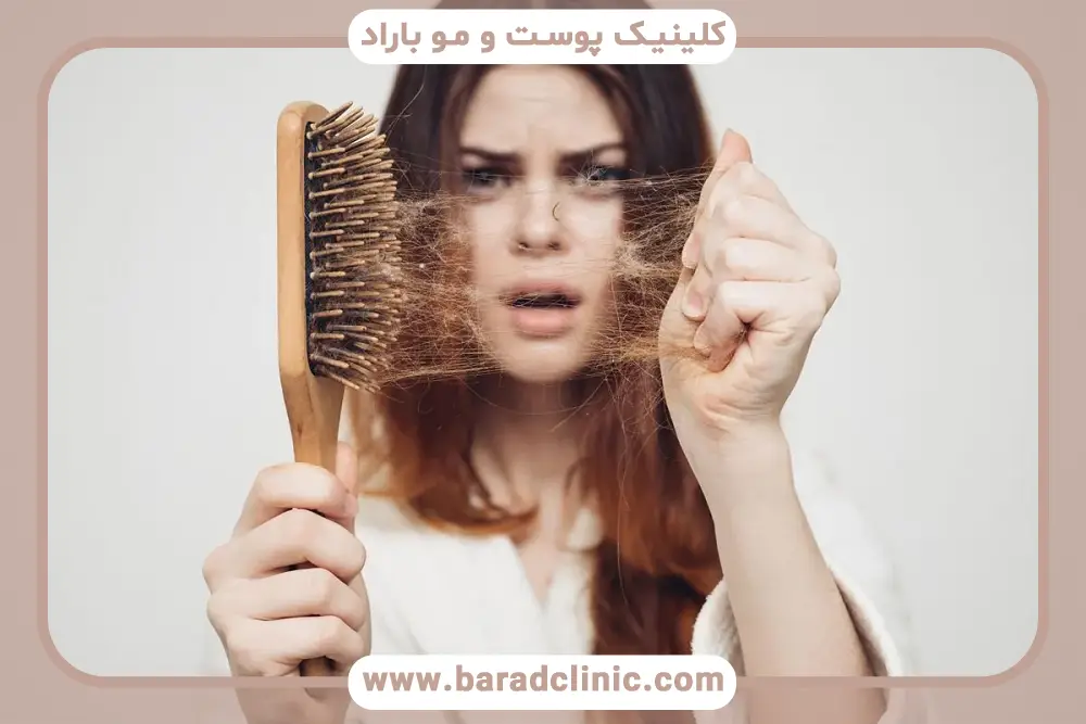 درمان ریزش مو زنان در خانه