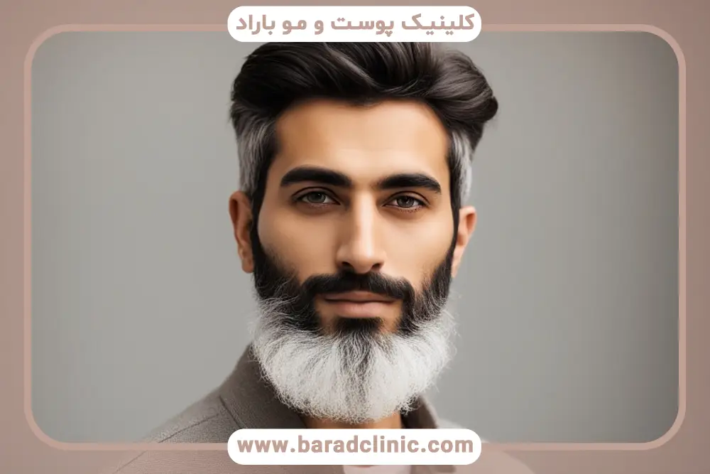علت تغییر رنگ ریش