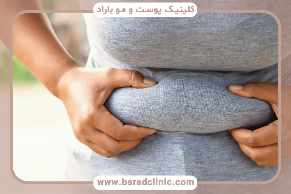 هزینه سلول درمانی برای لاغری