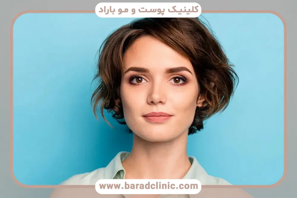 کاشت مو برای زنان کم مو