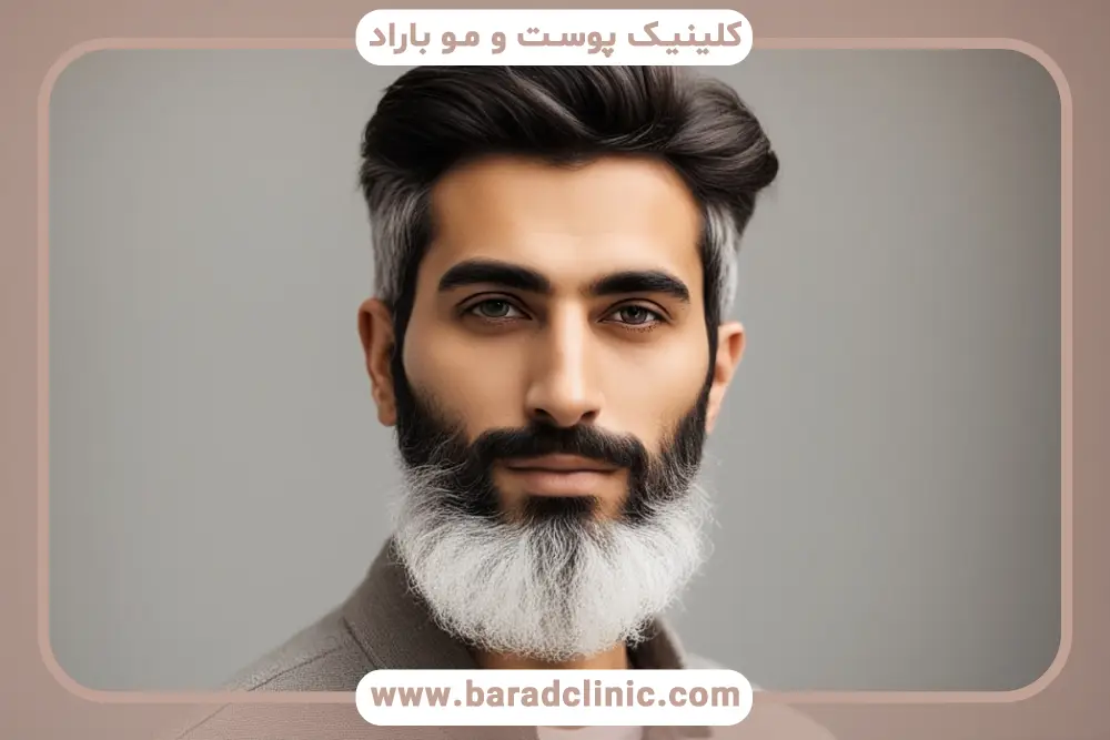 علت سفید شدن ریش