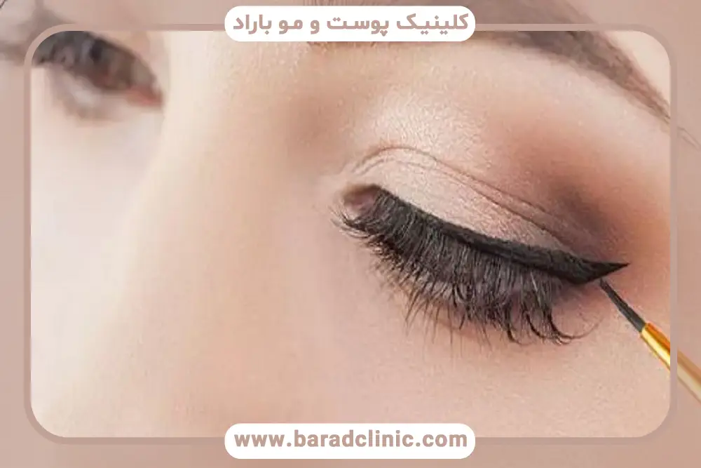 ترمیم عمل بلفاروپلاستی