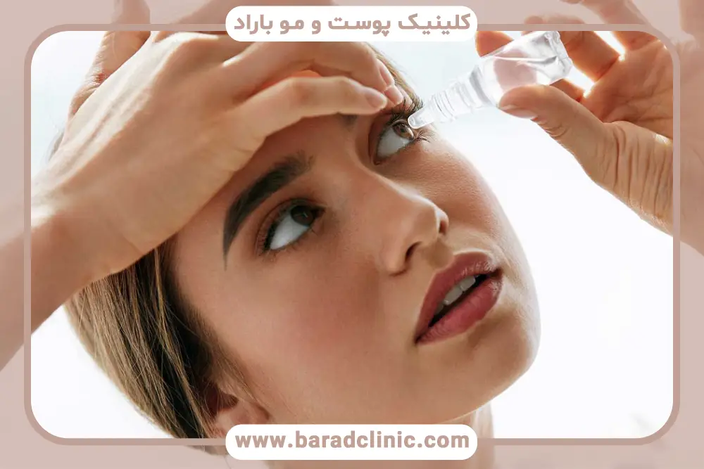 شستشوی چشم بعد از عمل بلفاروپلاستی