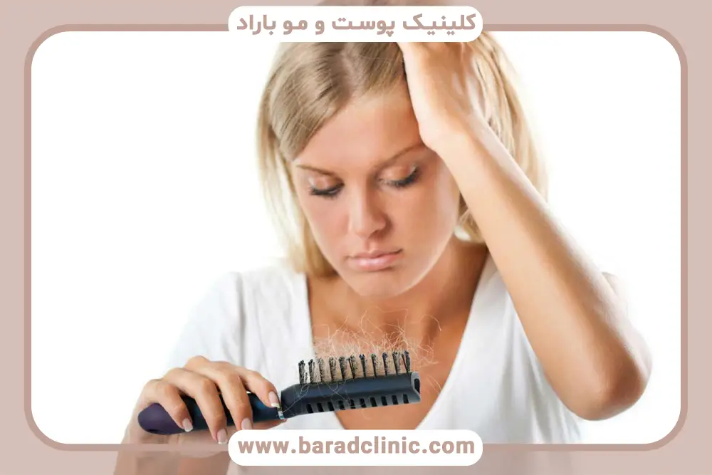 علت ریزش شدید مو در زنان