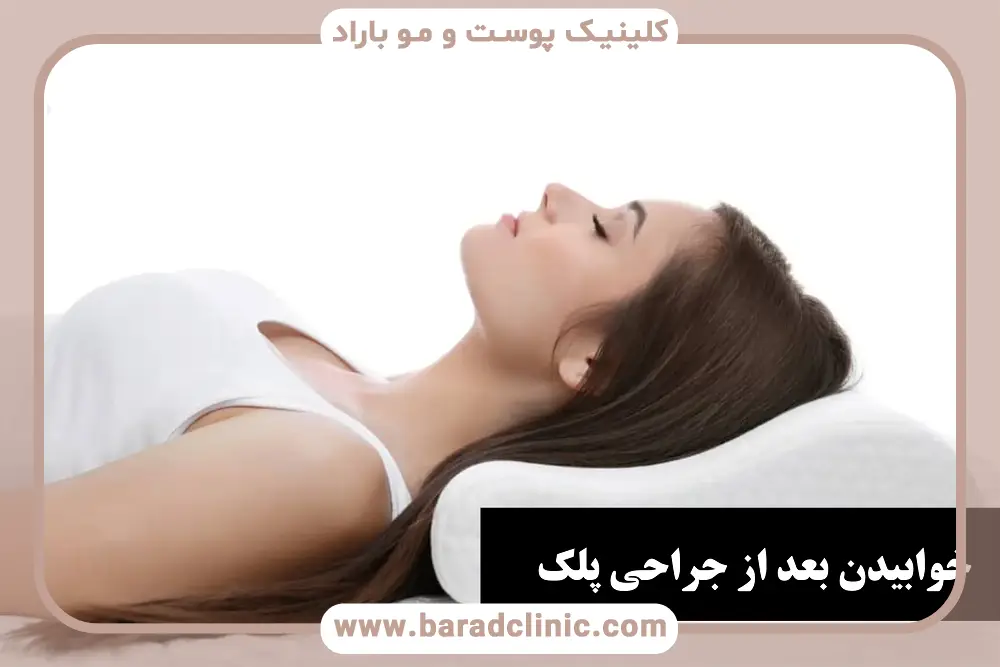 نحوه خوابیدن بعد از عمل بلفاروپلاستی