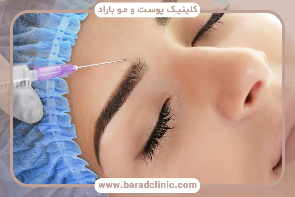 مزوتراپی ابرو درد دارد؟