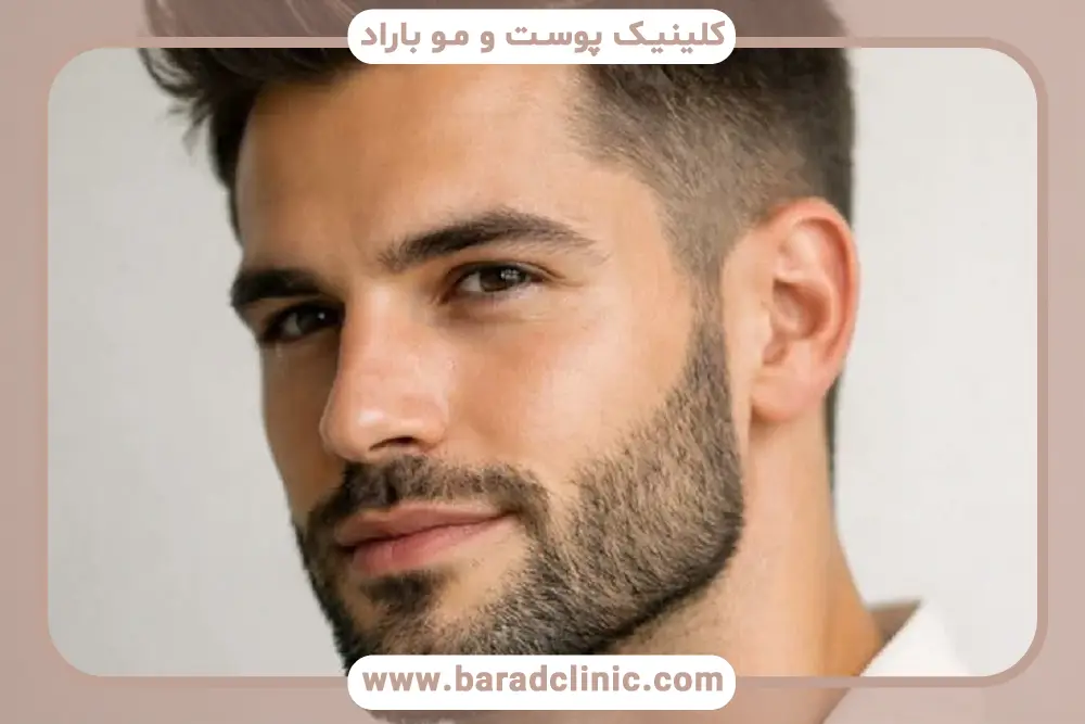 DHT و رشد ریش
