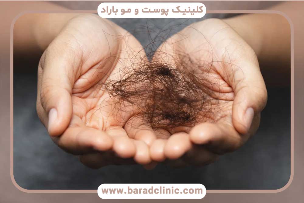چالش‌های کم کاری تیروئید و کاشت ابرو