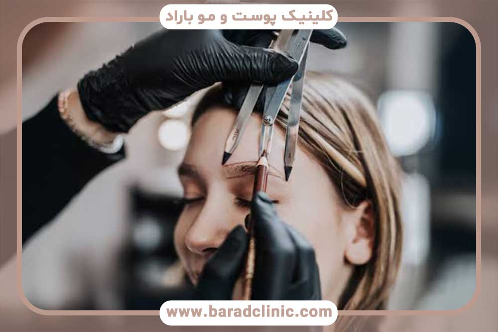 عوامل موثر بر هزینه کاشت ابرو
