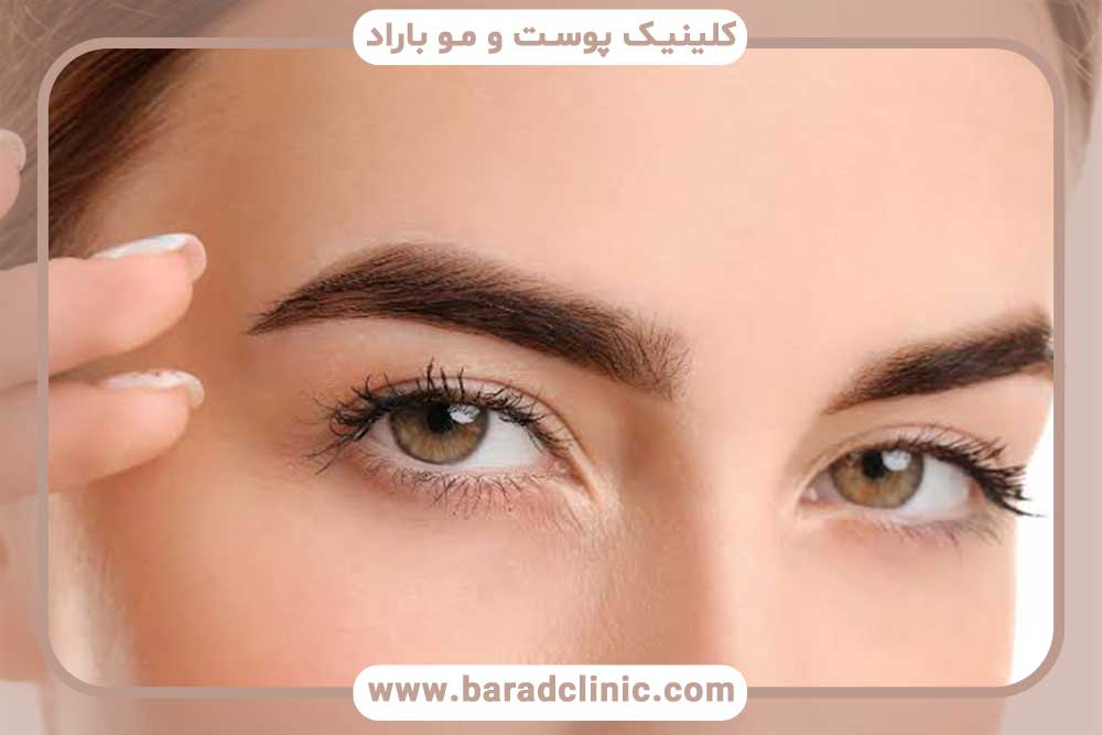 عوامل موثر بر ماندگاری کاشت ابرو
