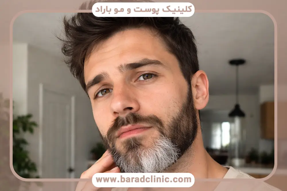 بررسی علت سفید شدن ریش 