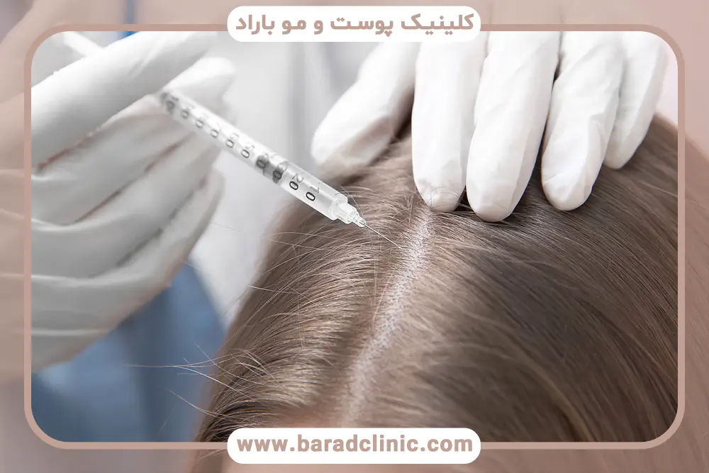 منظور از درمان سریع ریزش مو 
