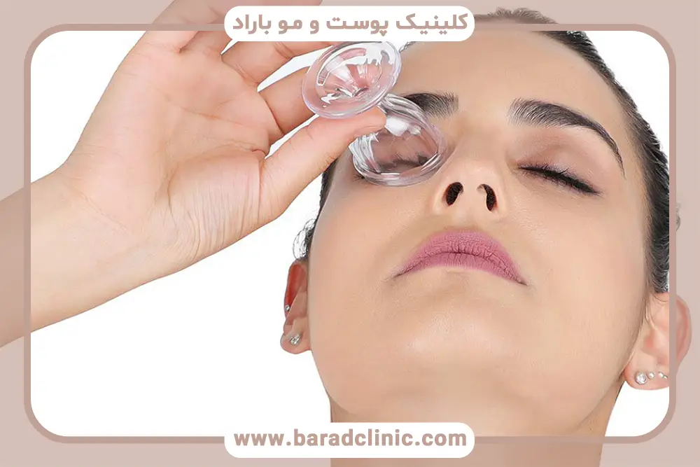 اهمیت شستشوی چشم بعد از عمل بلفاروپلاستی