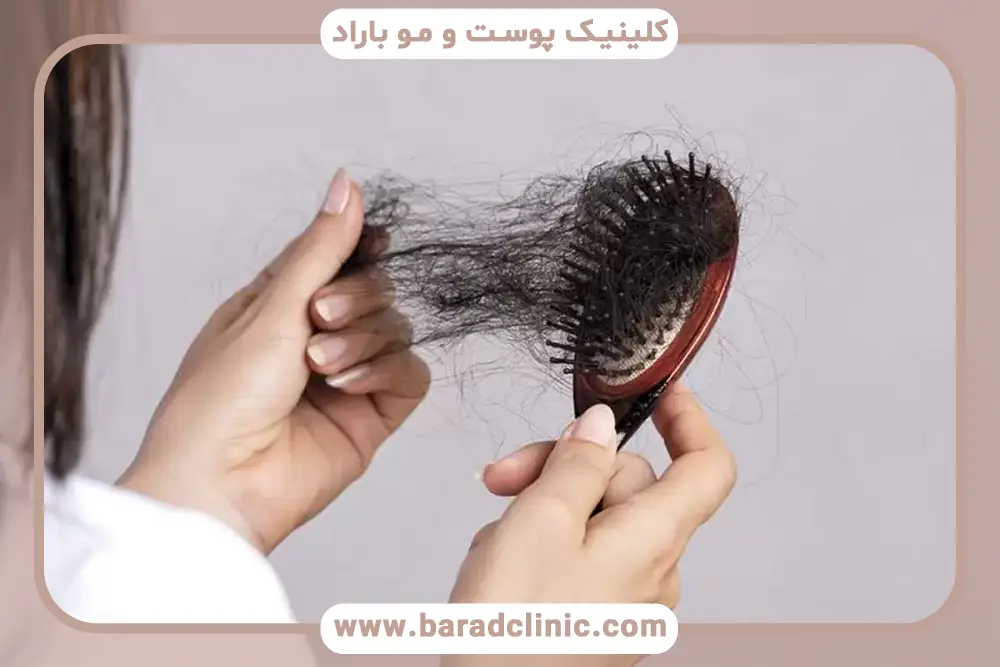 اهمیت جدی گرفتن علت ریزش شدید مو در زنان