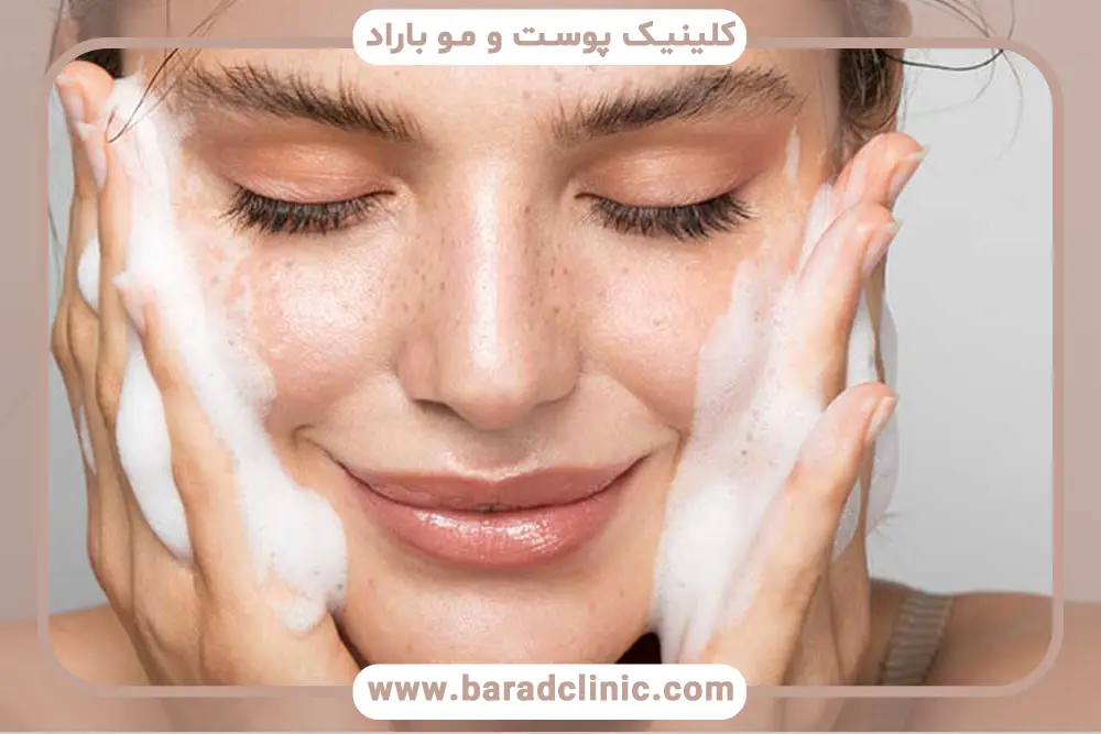 بعد از عمل بلفاروپلاستی کی حمام کنیم؟ بررسی کلی