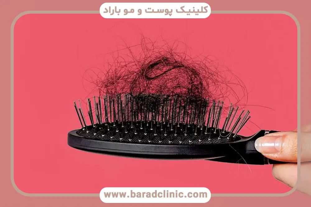 بررسی کبد چرب و ریزش مو 