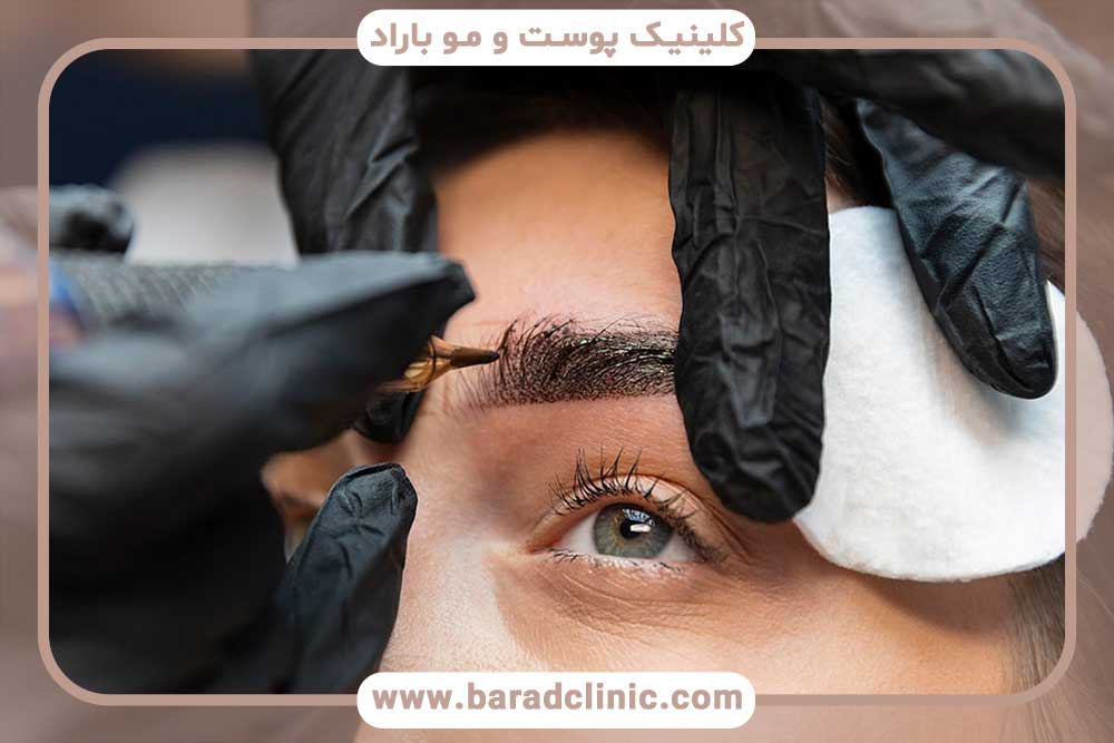 مزایای میکروبلیدینگ ابرو