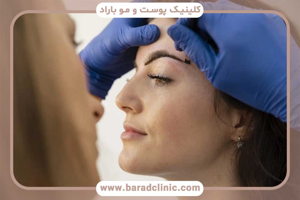 هزینه کاشت ابرو در روش‌های مختلف