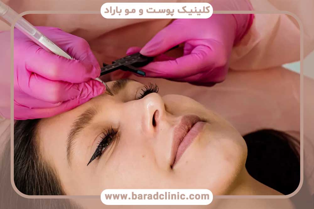 مقایسه کاشت ابرو با فیبروز ابرو