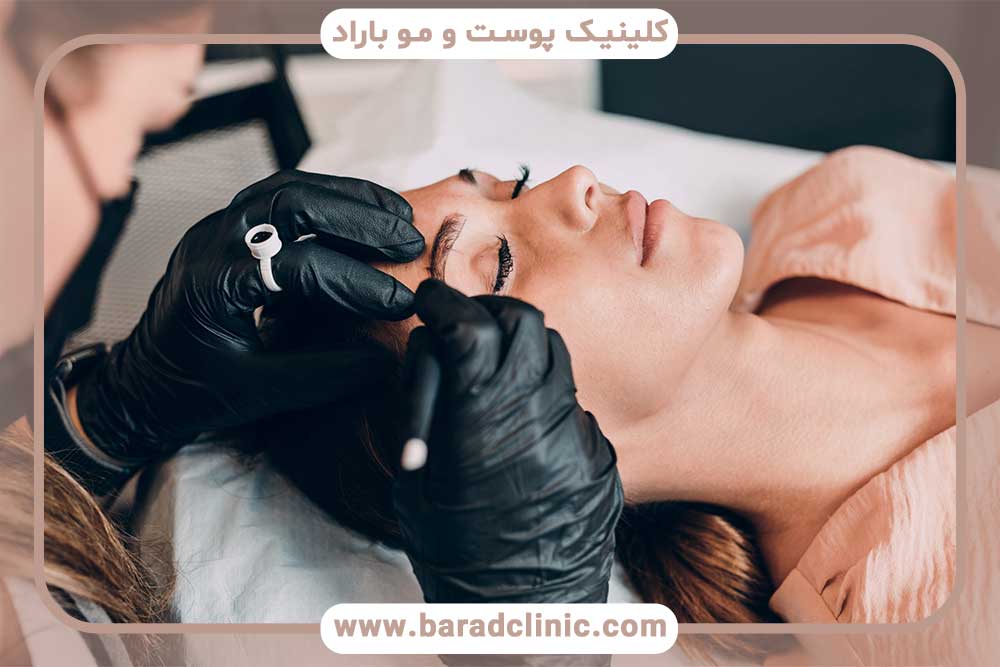 کاهش عوارض میکروبلیدینگ