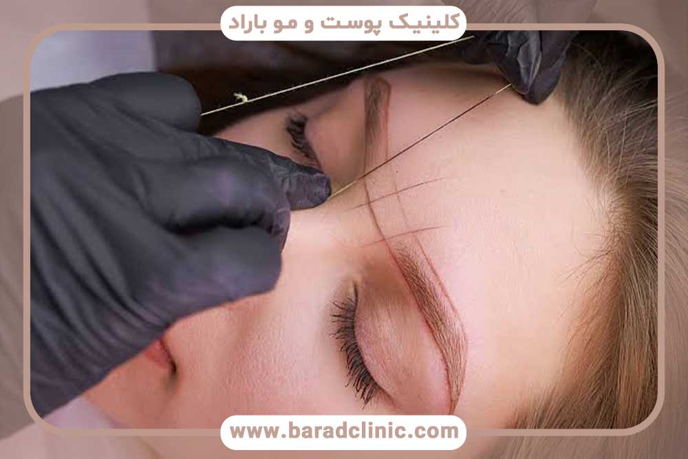 افزایش ماندگاری کاشت ابرو