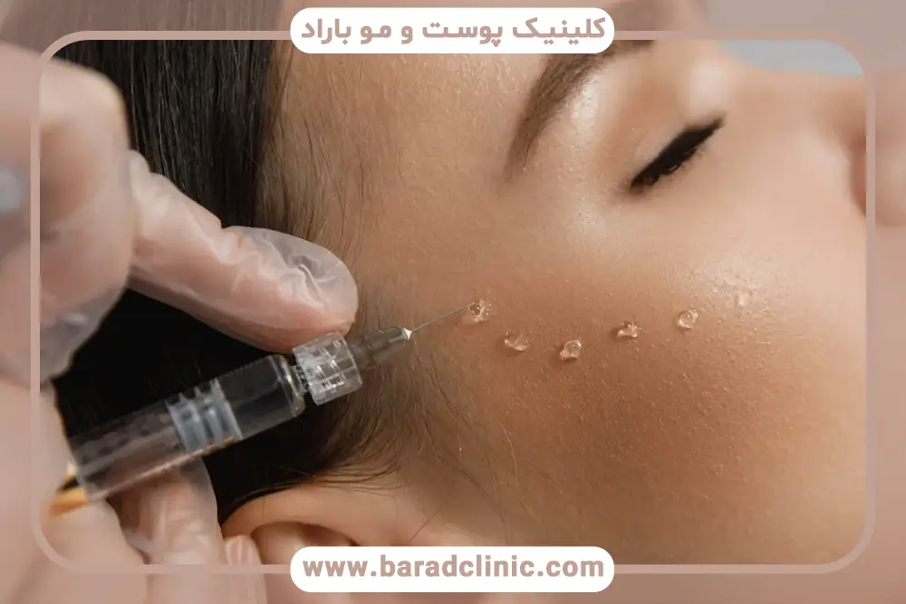 بهترین زمان شروع مزوتراپی جای بخیه