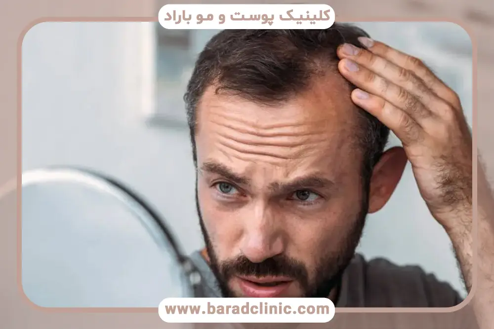 رژیم غذایی برای درمان ریزش مو از ریشه 