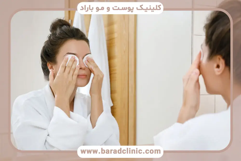 مراحل شستشوی چشم بعد از عمل بلفاروپلاستی