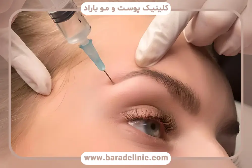 مزوتراپی ابرو درد دارد؟ نقش سوزن مزوتراپی