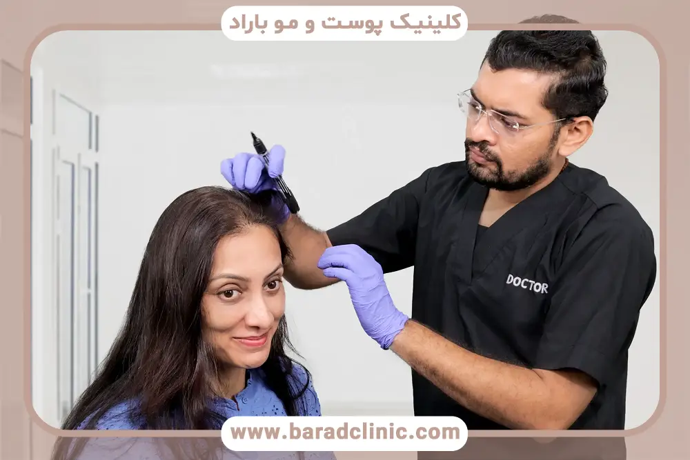 نمونه کارهای بهترین دکتر کاشت مو در ایران