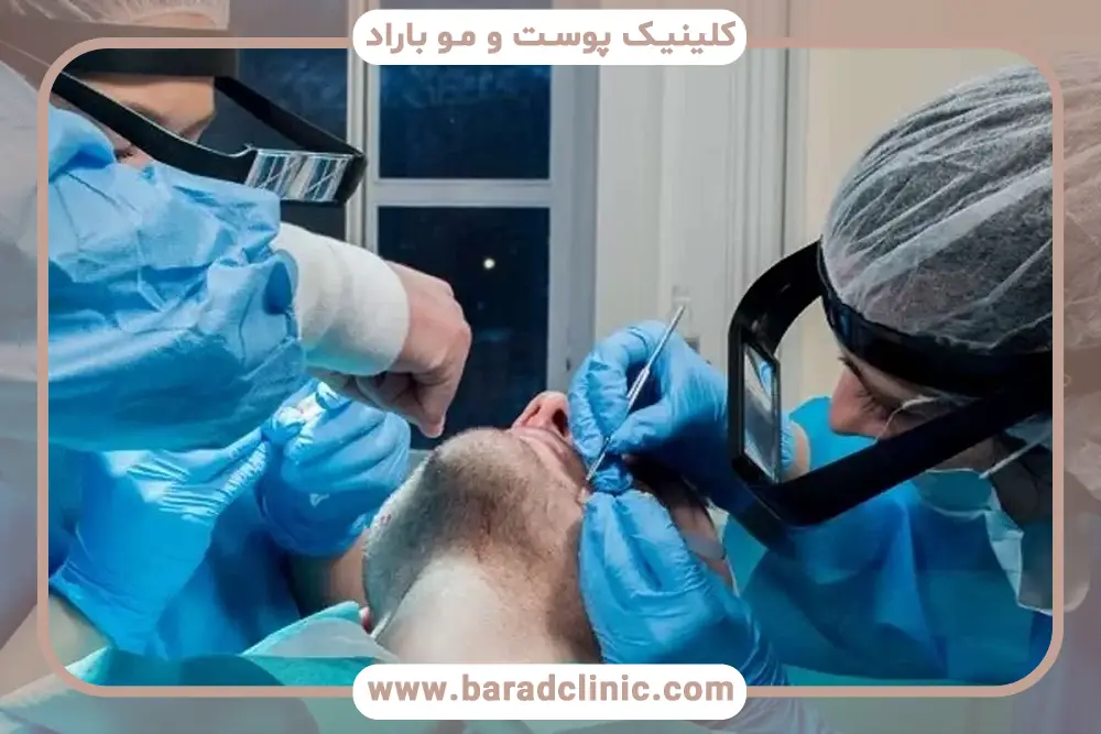 کاشت ریش درد دارد؟ بررسی روش‌ها