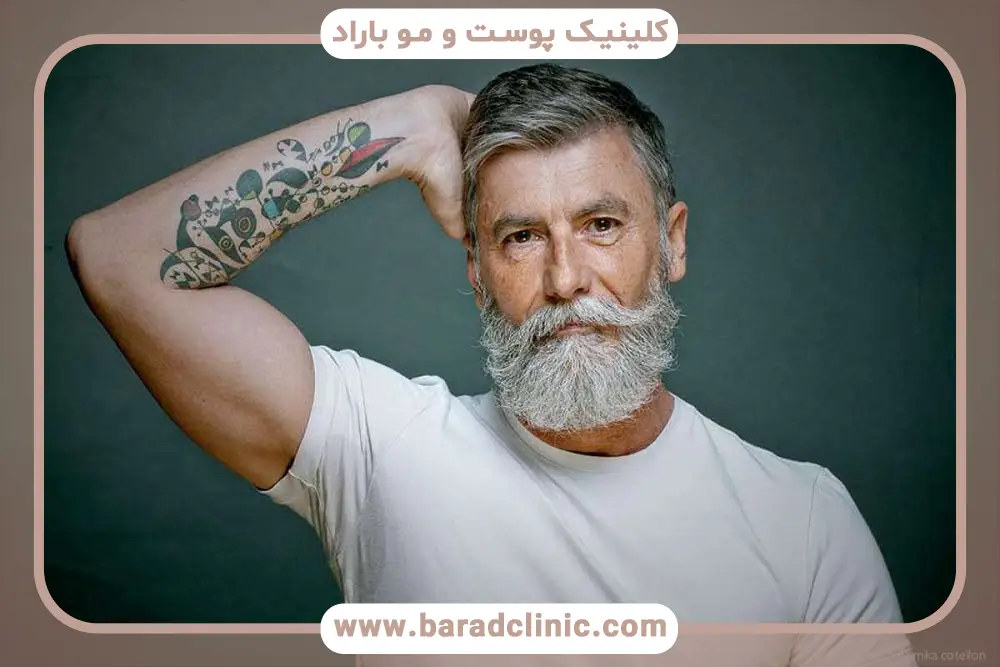 نحوه ارزیابی بانک مو برای کاشت ریش 