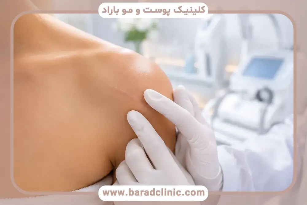 تعداد جلسات مزوتراپی جای بخیه