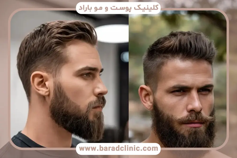 افزایش سن یک علت تغییر رنگ ریش 