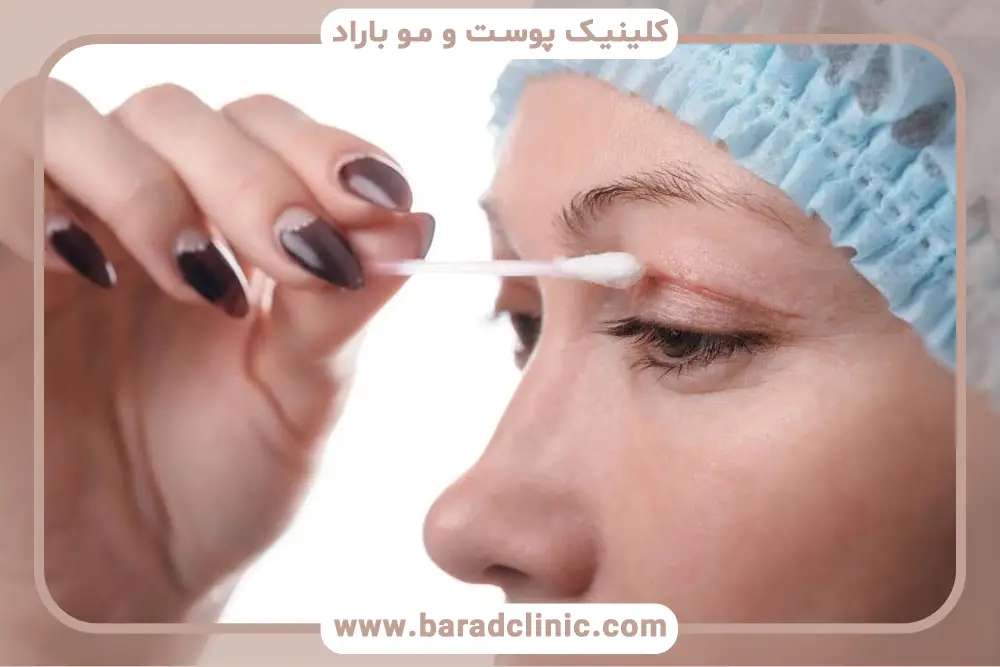 بعد از عمل بلفاروپلاستی کی حمام کنیم؟ اشتباهات رایج