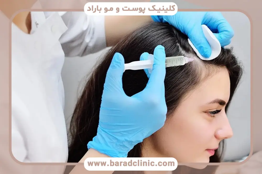 پی آر پی مو بهتر است یا مزوتراپی