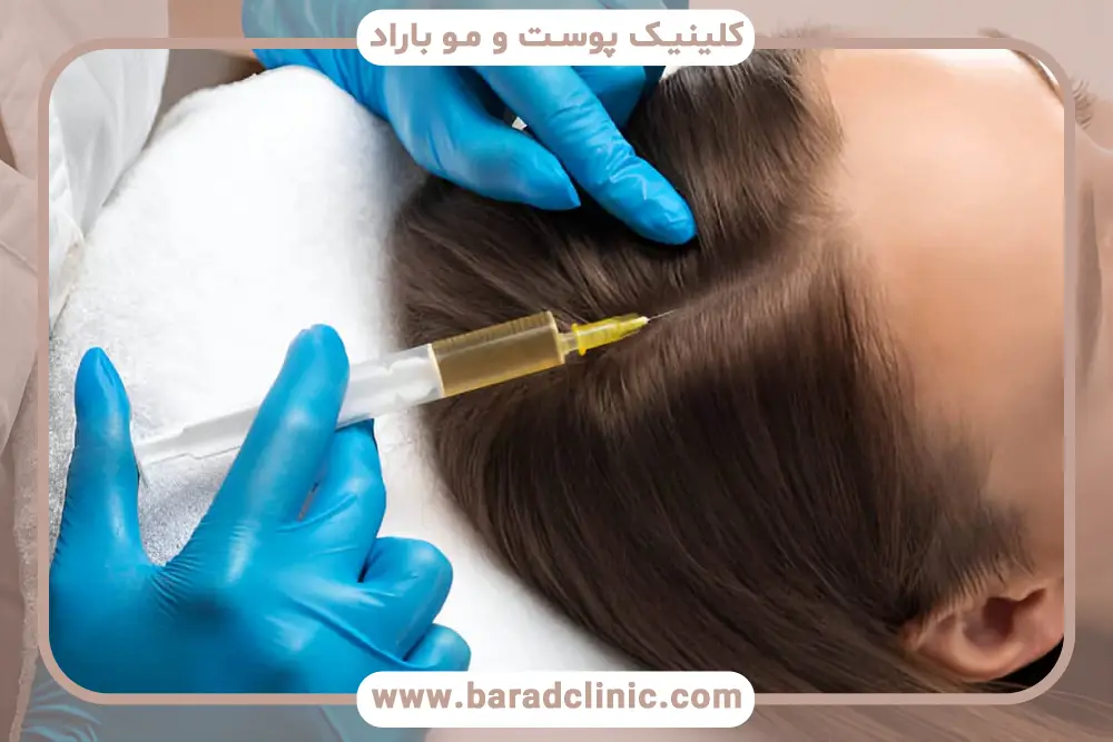 پی آر پی مو چند درصد جواب میده؟