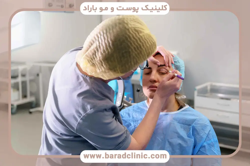 افتادگی ناگهانی پلک